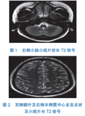 僵尸之路 相关产品