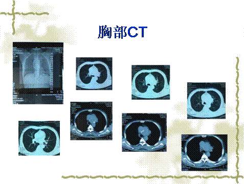 冷眼杀机 相关产品