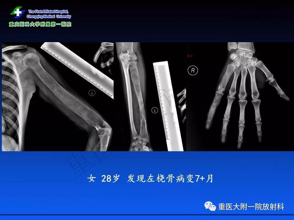 僵尸英雄之魔王与公主 相关产品