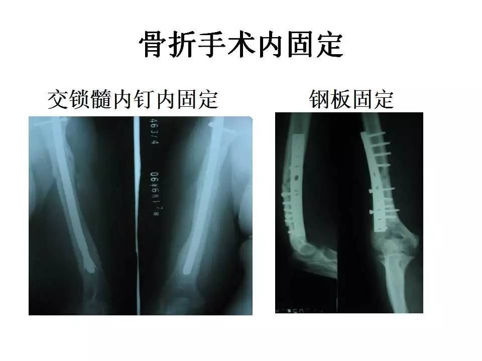 冷面虎 相关产品